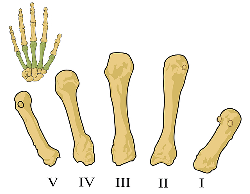 Five Effective Ways for People with Osteoporosis to Prevent Fractures