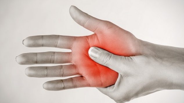 Commonly Asked Questions About Arthritis