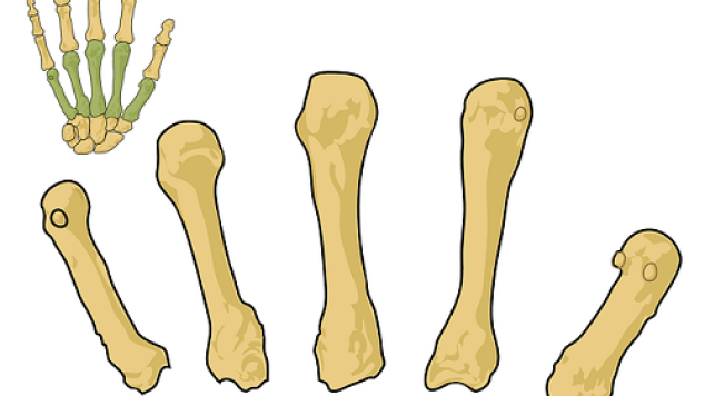 Five Effective Ways for People with Osteoporosis to Prevent Fractures