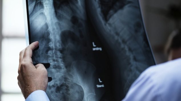 How does Bone Density Correlate to Heart Health?